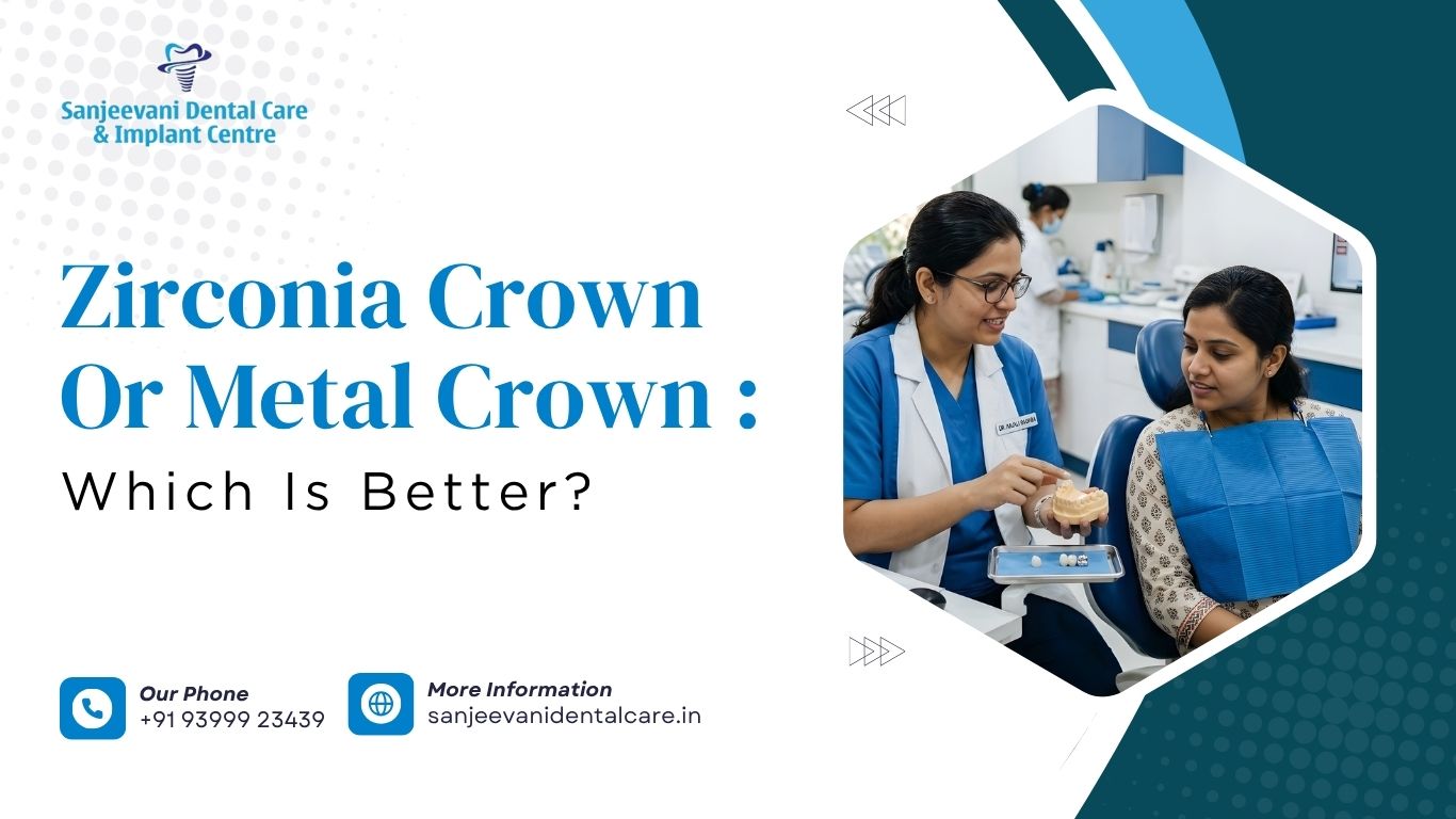 Zirconia Crown or Metal Crown: Which is Better?